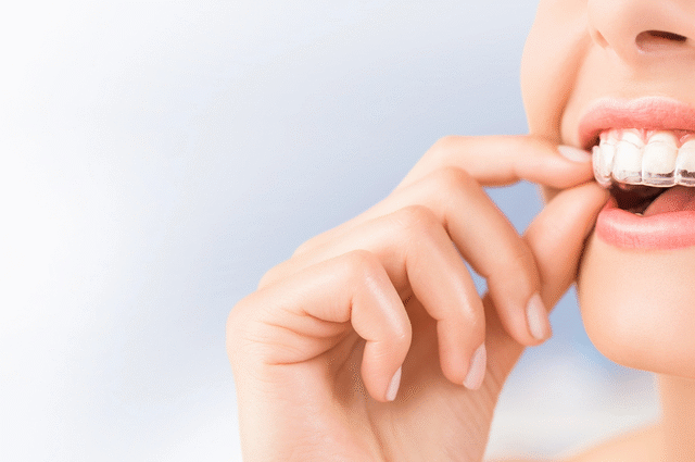Can Invisalign Fix Overbites and Underbites?
